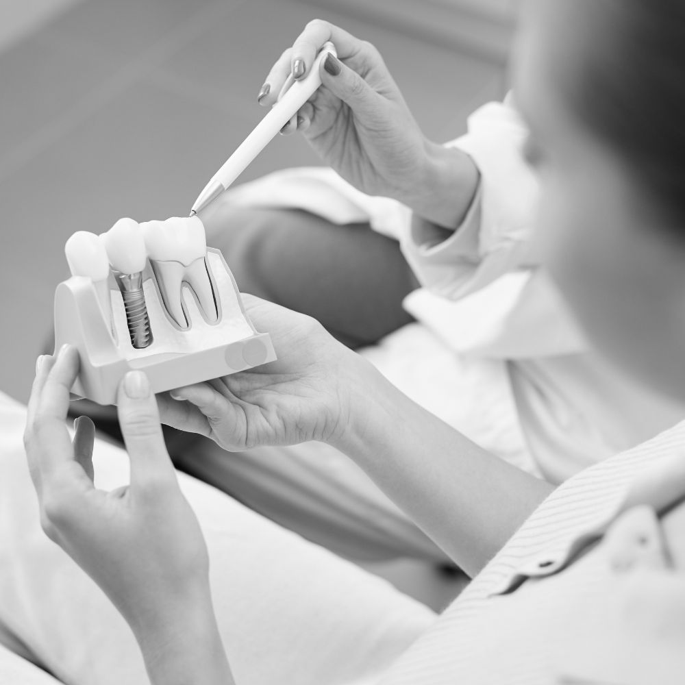 Conseils implantaires - dentiste Sene