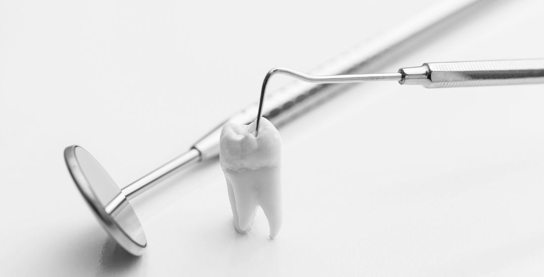 Chirurgie préimplantaire dentiste Sene